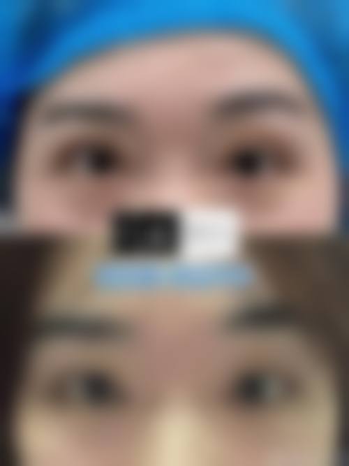 四、重庆非梵整形医院特色项目