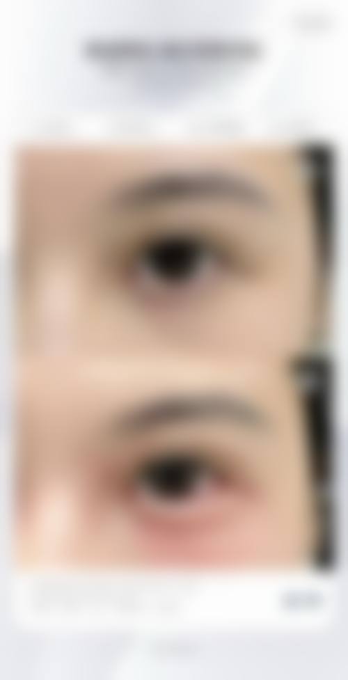 五、深圳瑞和医疗美容医院价格表