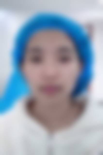 八、深圳瑞和医疗美容医院真实的患者评价