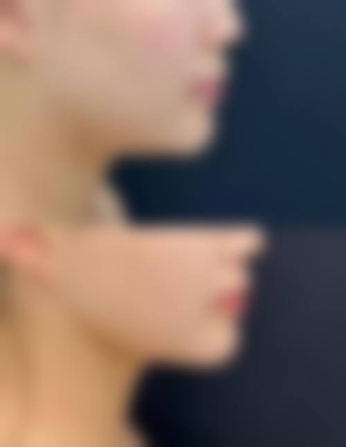 七、深圳市第二人民医院烧伤整形外科地址及交通