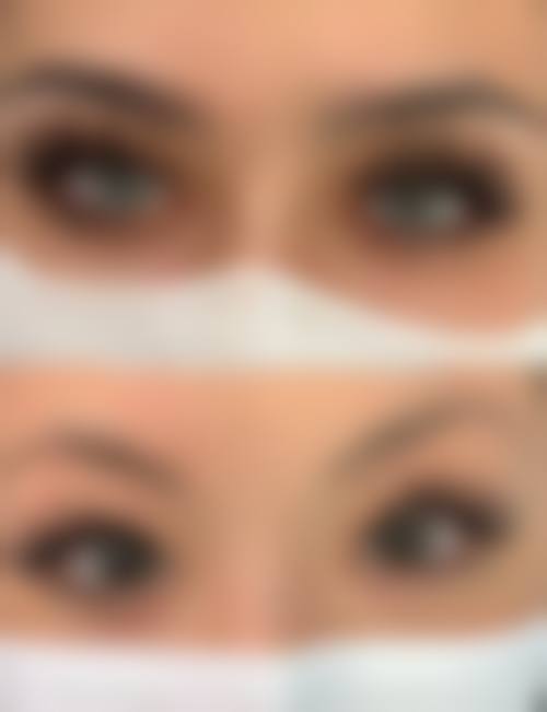 九、广州穗雅医院植发科真实的患者评价