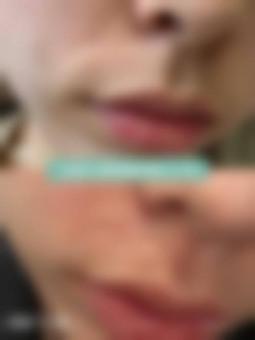 六、深圳市第二人民医院烧伤整形外科价格表