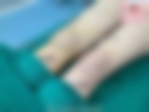 八、武汉施美尔医学美容医院真实的患者评价