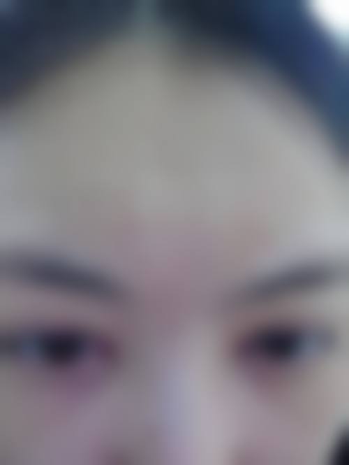 九、厦门思明欧菲医疗美容机构真实的患者评价