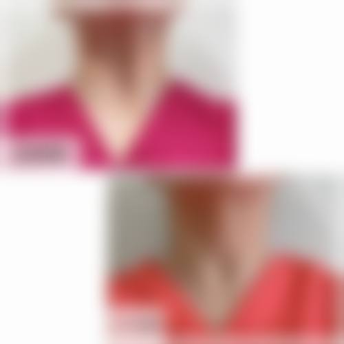 五、重庆张瑜整形医疗美容价格表