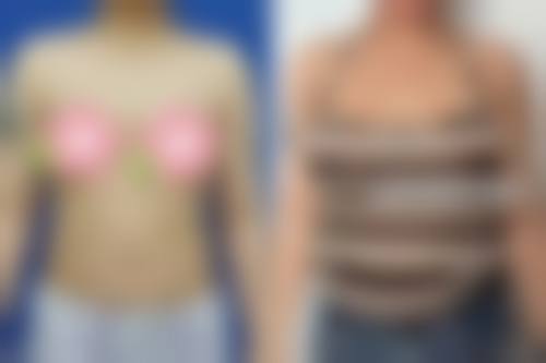 八、重庆张瑜整形医疗美容真实的患者评价