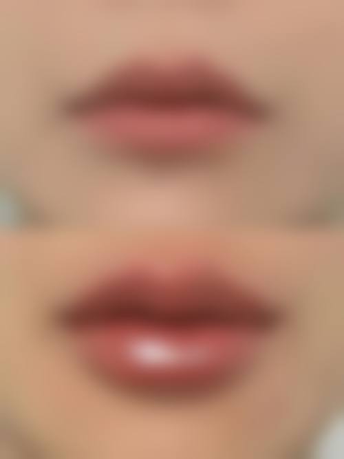 二、重庆张瑜整形医疗美容怎么样？