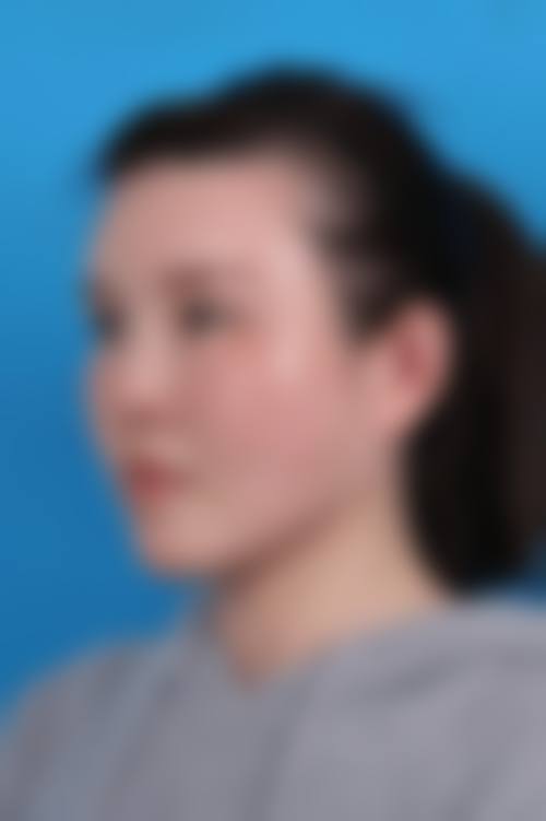 三、重庆张瑜整形医疗美容诊疗项目有哪些？