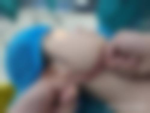 四、郑州美贝整形医院特色项目