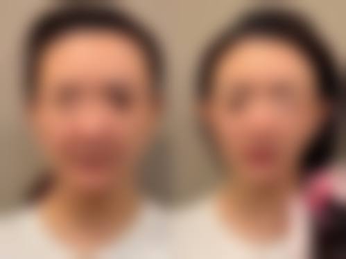 二、韩国SR整形医院怎么样？