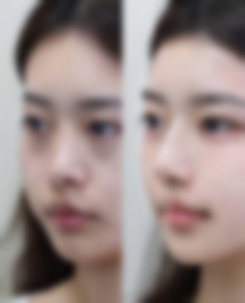 新生儿什么时候变双眼皮正常？了解影响因素与时间跨度，家长不必焦虑！ 