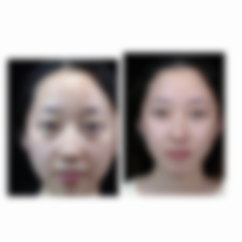 四、告别下眼袋发黑的小秘诀