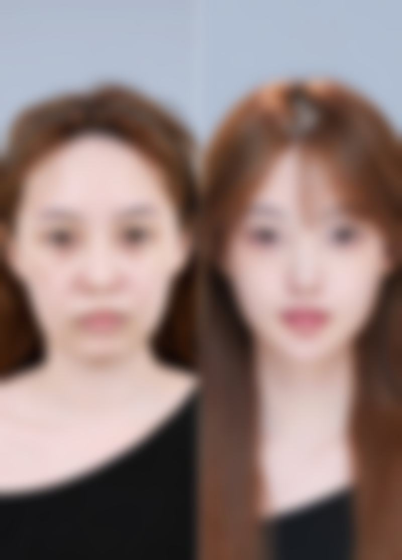 二、牛奶营养成分对疤痕修复的间接作用