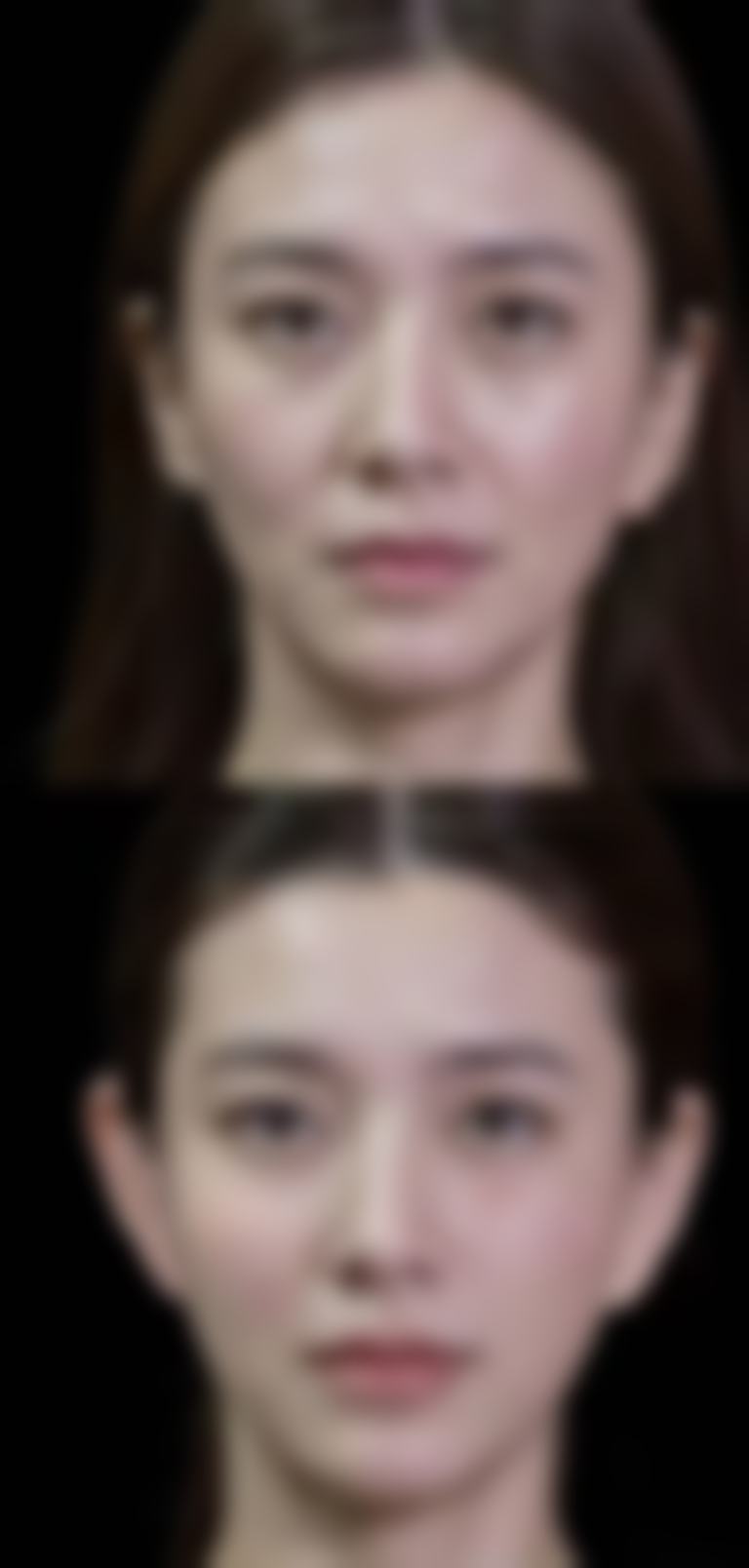 三、韩国SR整形医院诊疗项目有哪些？