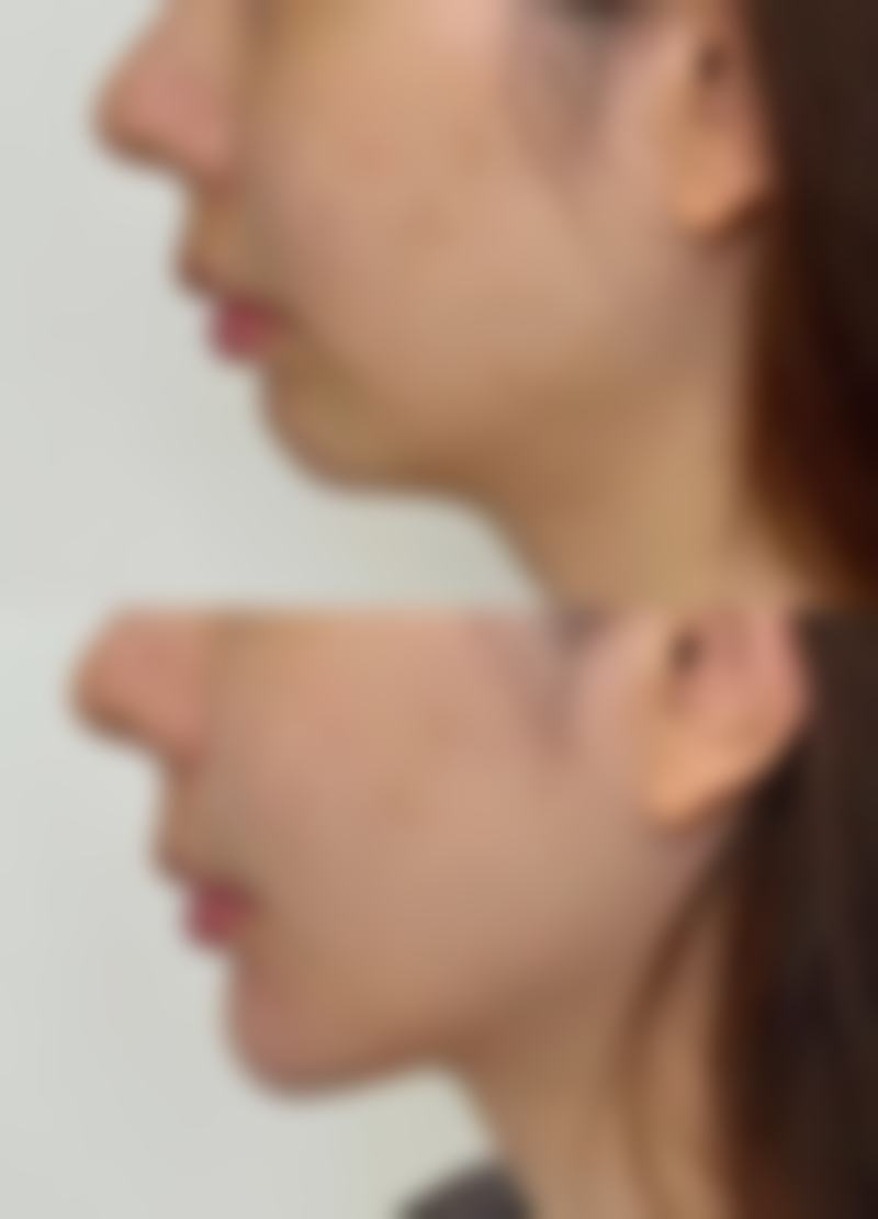 七、海南梦妮幻整形美容机构预约方式