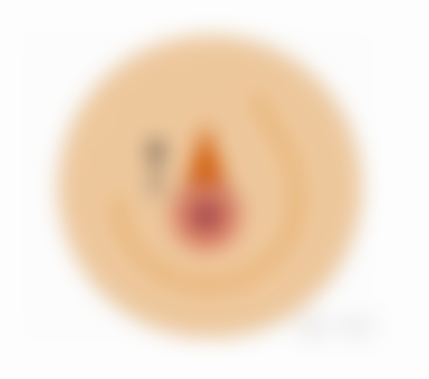 三、有眼袋应该考虑的轻医美手段