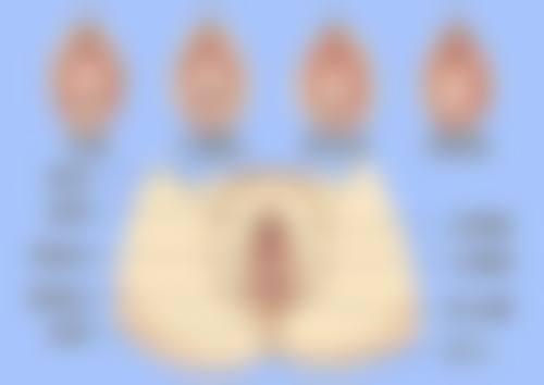 四、打瘦脸针没成效的美学与安心性提示