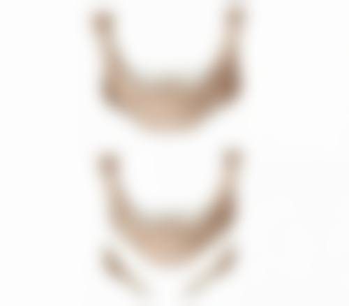 一、隆鼻后鼻头修复的一般时间规律