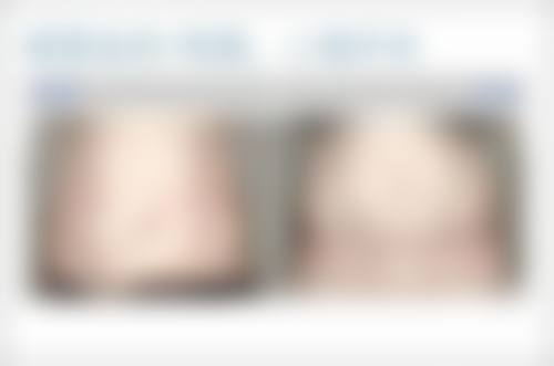 六、打瘦脸针没成效后的沟通与心态调整