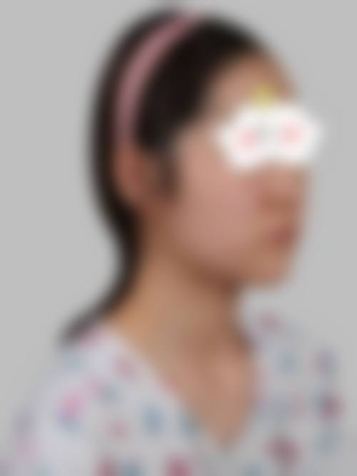 九、马鞍山美芙医疗美容门诊部真实的患者评价