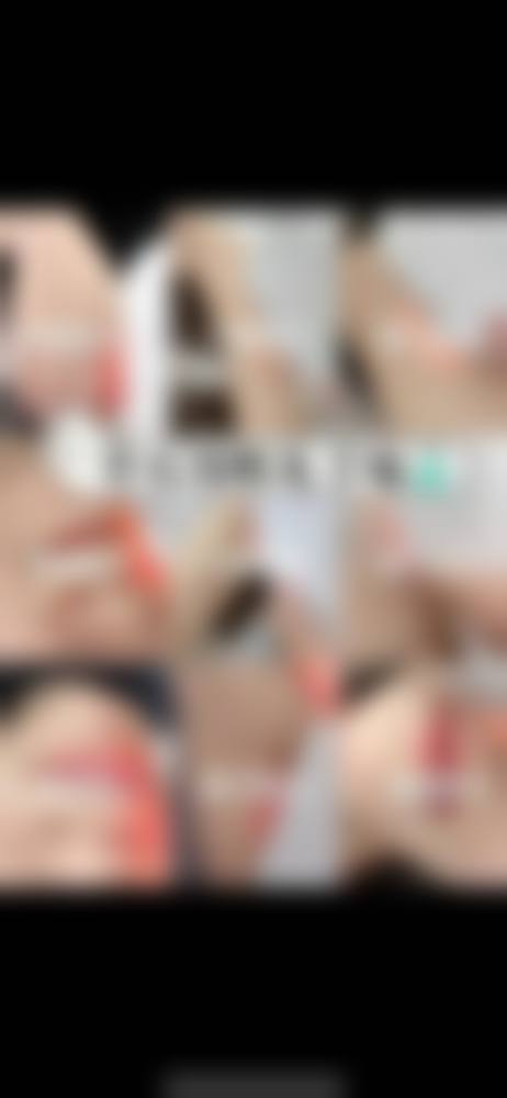 九、安阳上城医疗美容诊所真实的患者评价