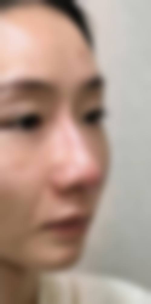 四、深圳欧美拉医疗美容诊所特色项目