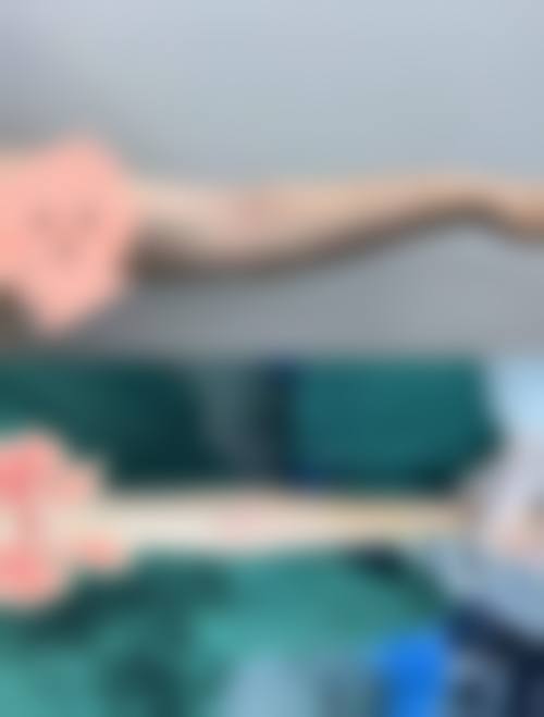 四、南宁壹莱美整形医院特色项目