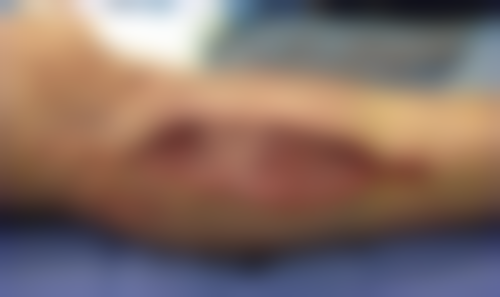 六、杭州艾菲(恒颜)整形医院价格表