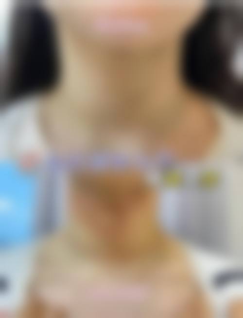 四、扬州邗江施尔美医疗美容整形医院特色项目