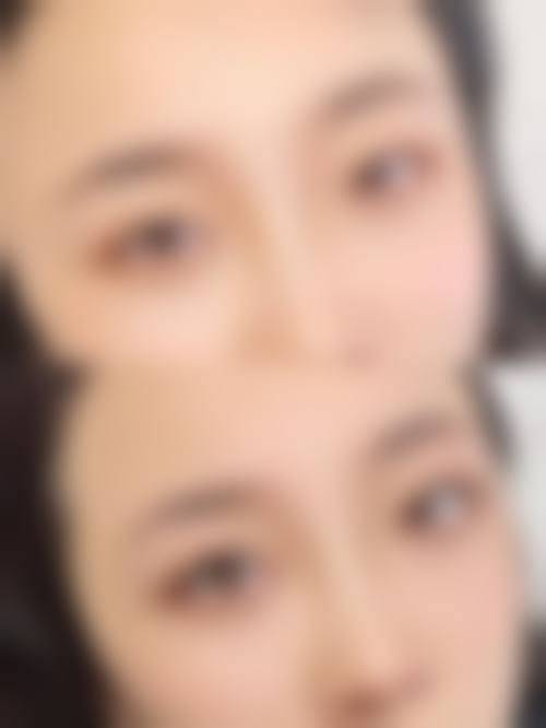 九、深圳欧美拉医疗美容诊所真实的患者评价