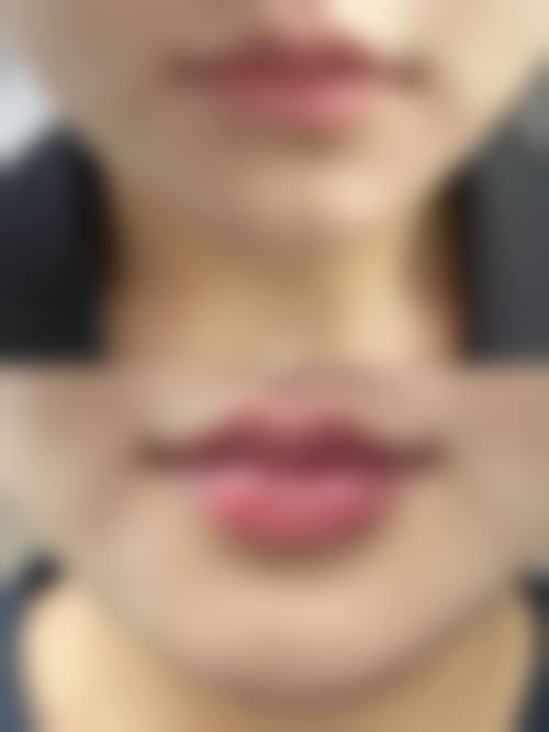 五、北京丽景洲际医疗美容价格表