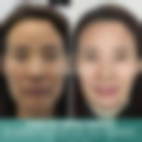 九、扬州邗江施尔美医疗美容整形医院真实的患者评价