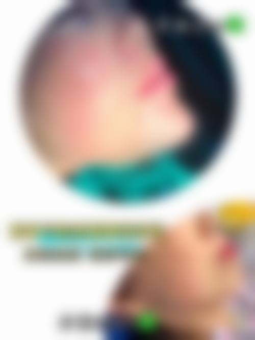 九、北京赫私本女己医疗美容诊所真实的患者评价