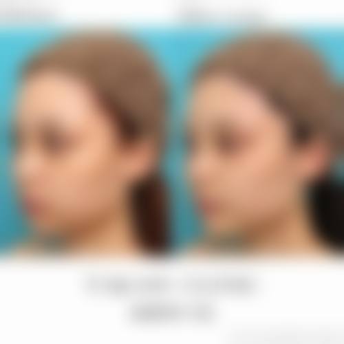 二、成都华人医联整形美容医院怎么样?