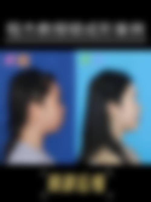 四、四川军大医学研究所附属医院美容整形科特色项目