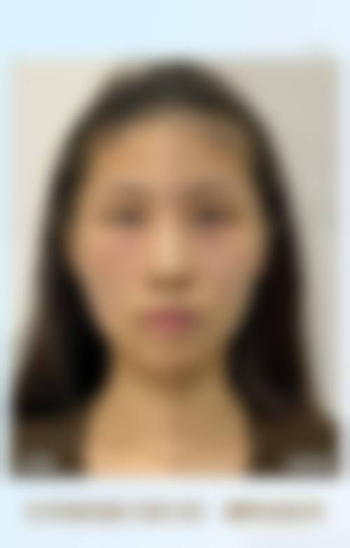 二、中山爱汇星辰整形医院怎么样？