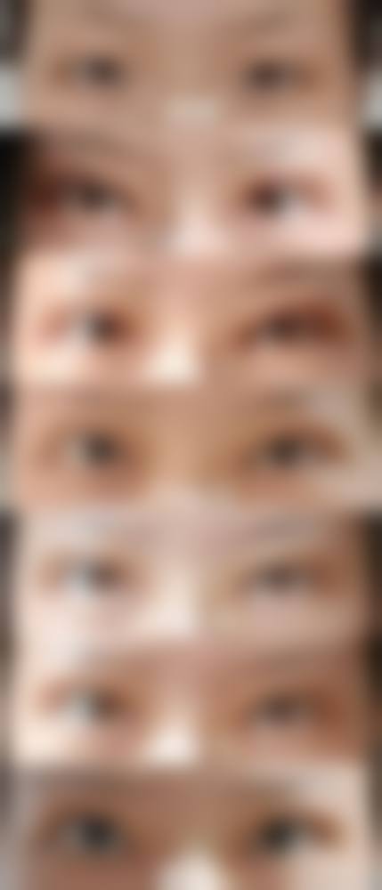 四、清远媄媄整形医院特色项目