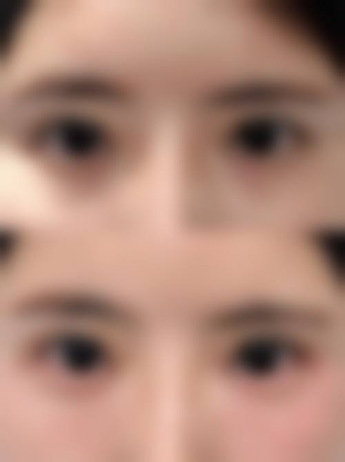 八、杭州艾菲(恒颜)整形医院预约方式