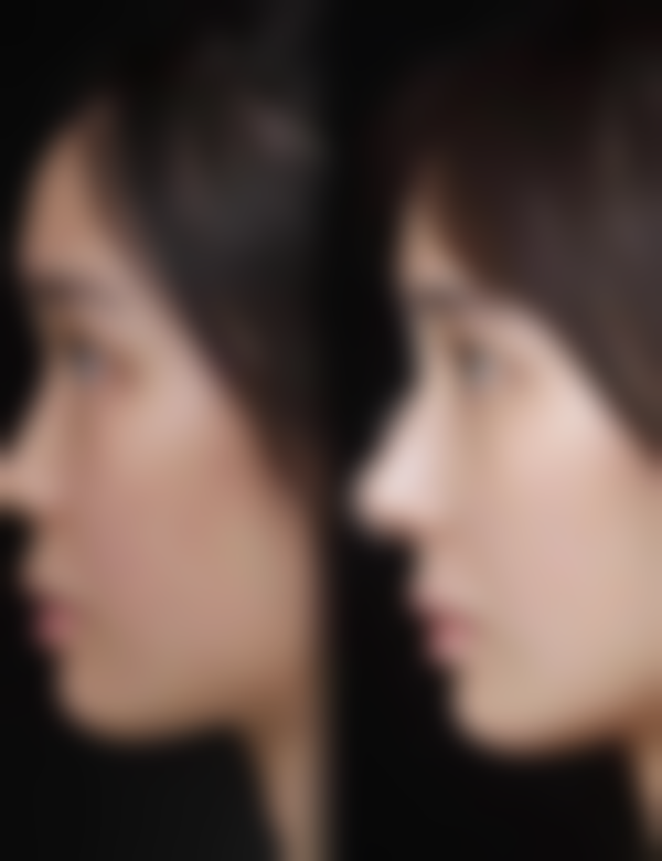 二、南宁壹莱美整形医院怎么样?