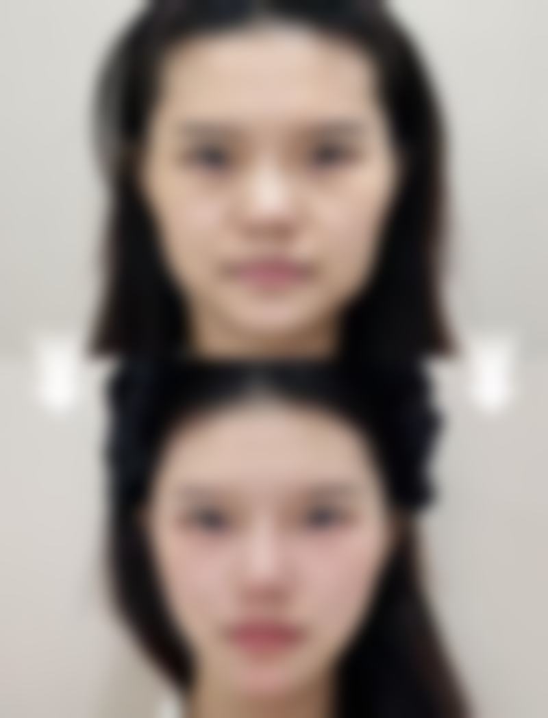 八、大连博士丽医疗美容门诊部真实的患者评价