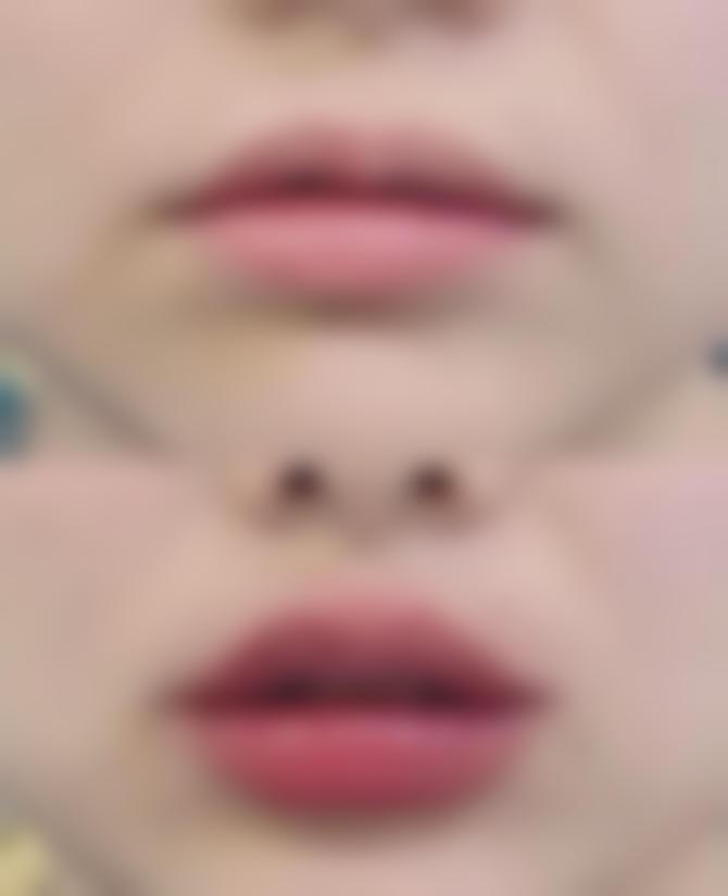 八、中山爱汇星辰整形医院真实的患者评价