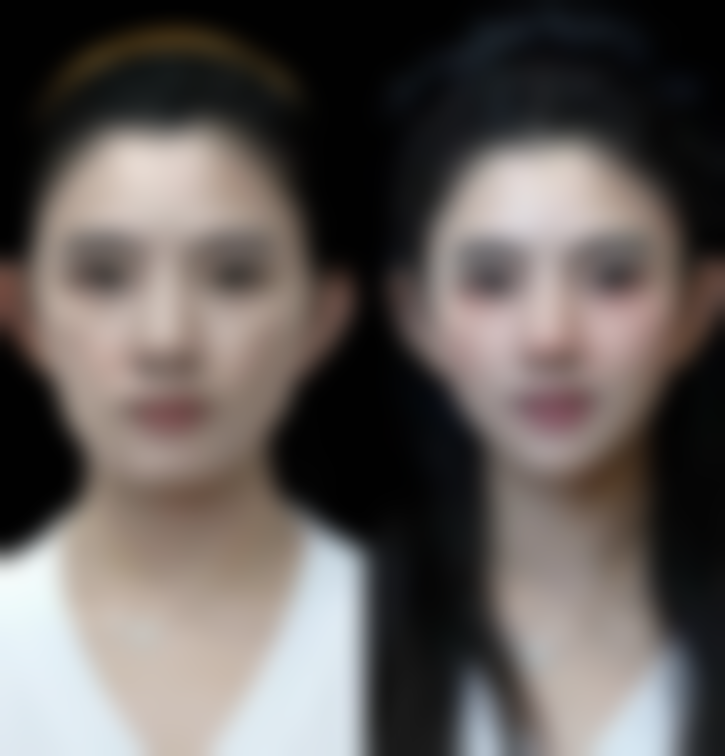 三、不同渗血情况的应对建议