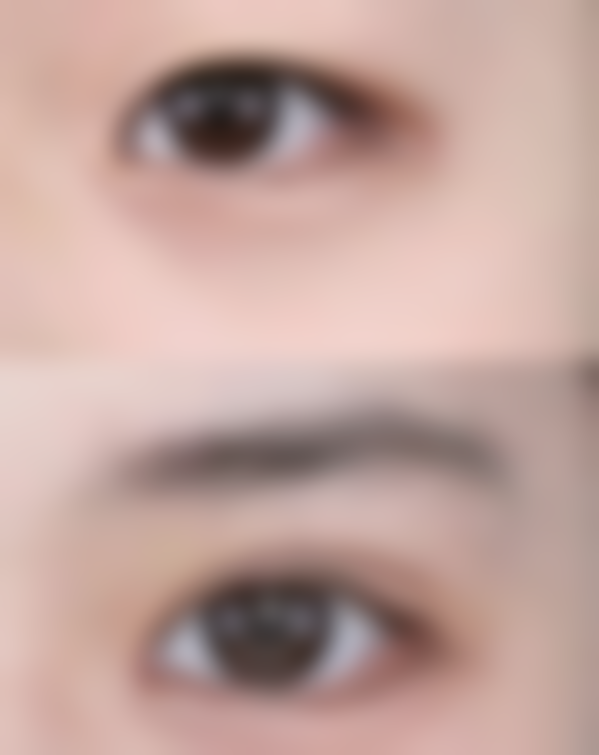 七、深圳栀颜整形医院预约方式