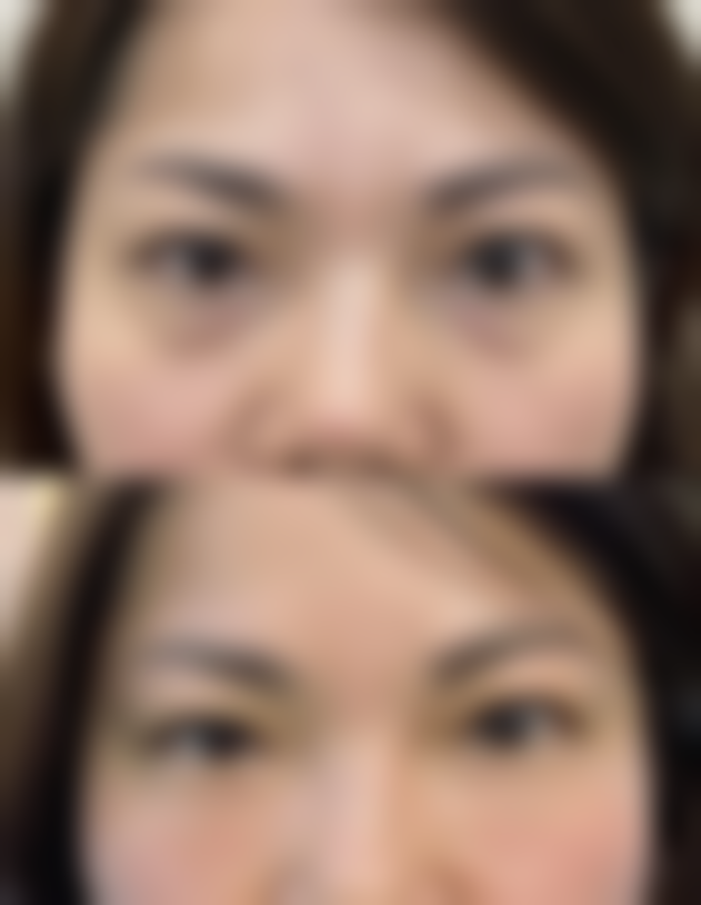 四、杭州艾菲(恒颜)整形医院特色项目