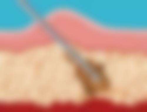 九、邢台媚思嘉医美真实的患者评价