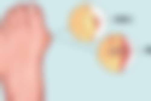 有什么办法可以丰太阳穴？了解穴位奥秘，解锁更多丰太阳穴新途径！ 