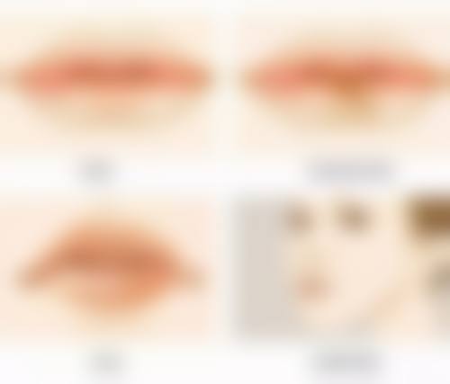 五、深圳红山赫美拉整形医院价格表