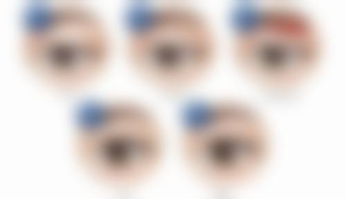 四、科学改善疤痕的常见方案