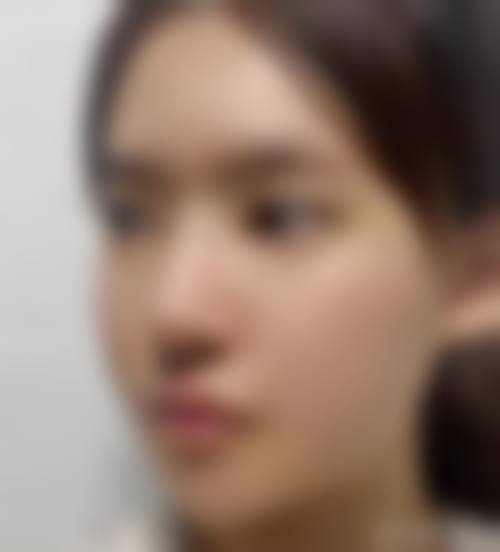 八、武汉伊莱丝医疗美容诊所真实的患者评价