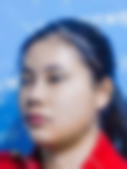 八、长春艾尔丽医疗美容门诊部真实的患者评价